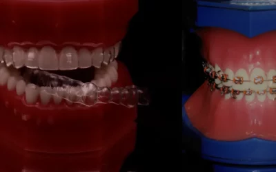 Orthodontie au Luxembourg : améliorer votre posture et votre bien-être