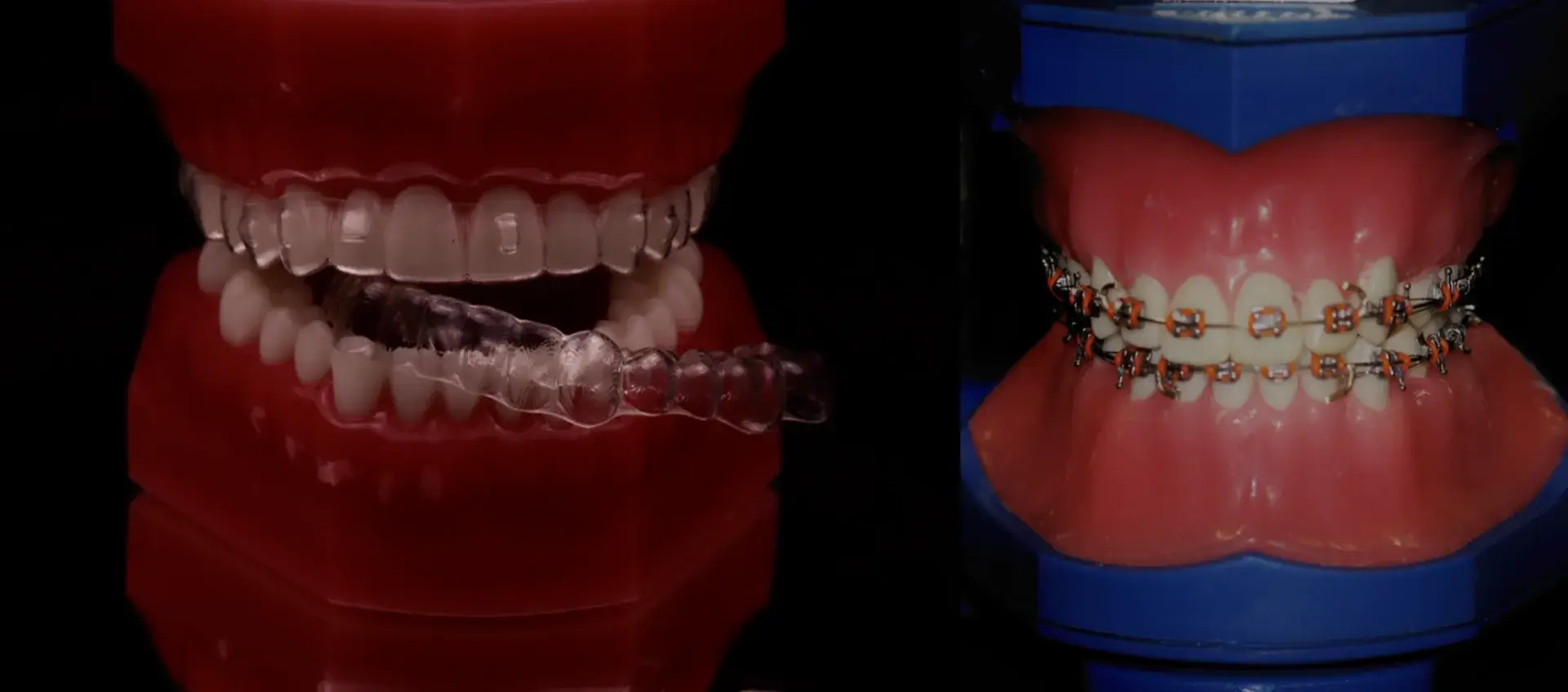 Orthodontie au Luxembourg : améliorer votre posture et votre bien-être