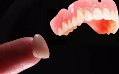 Comment une prothèse dentaire à Esch-sur-Alzette peut restaurer votre sourire et votre fonction masticatoire ?